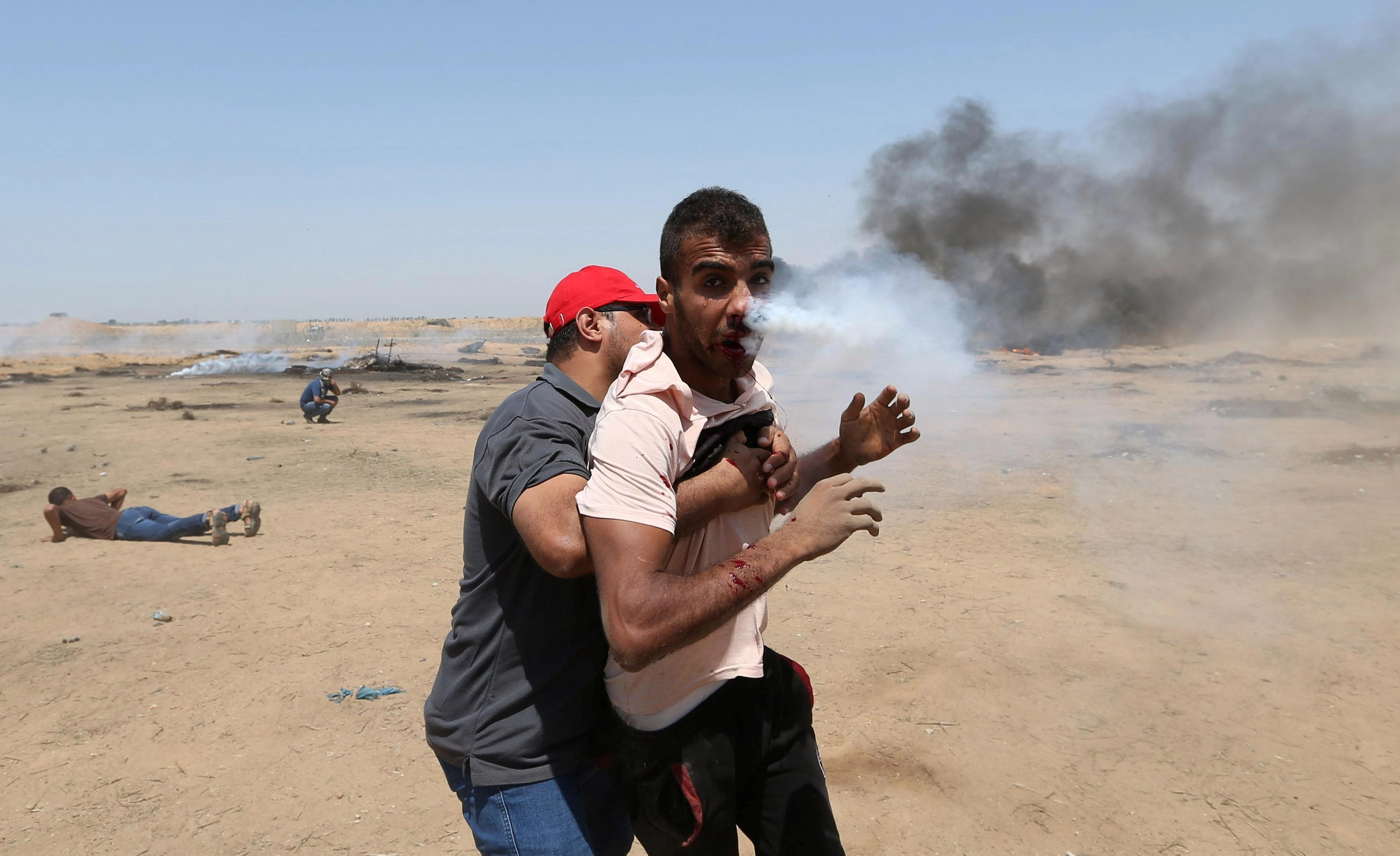 وصول المصاب هيثم أبو سبله من قطاع غزة