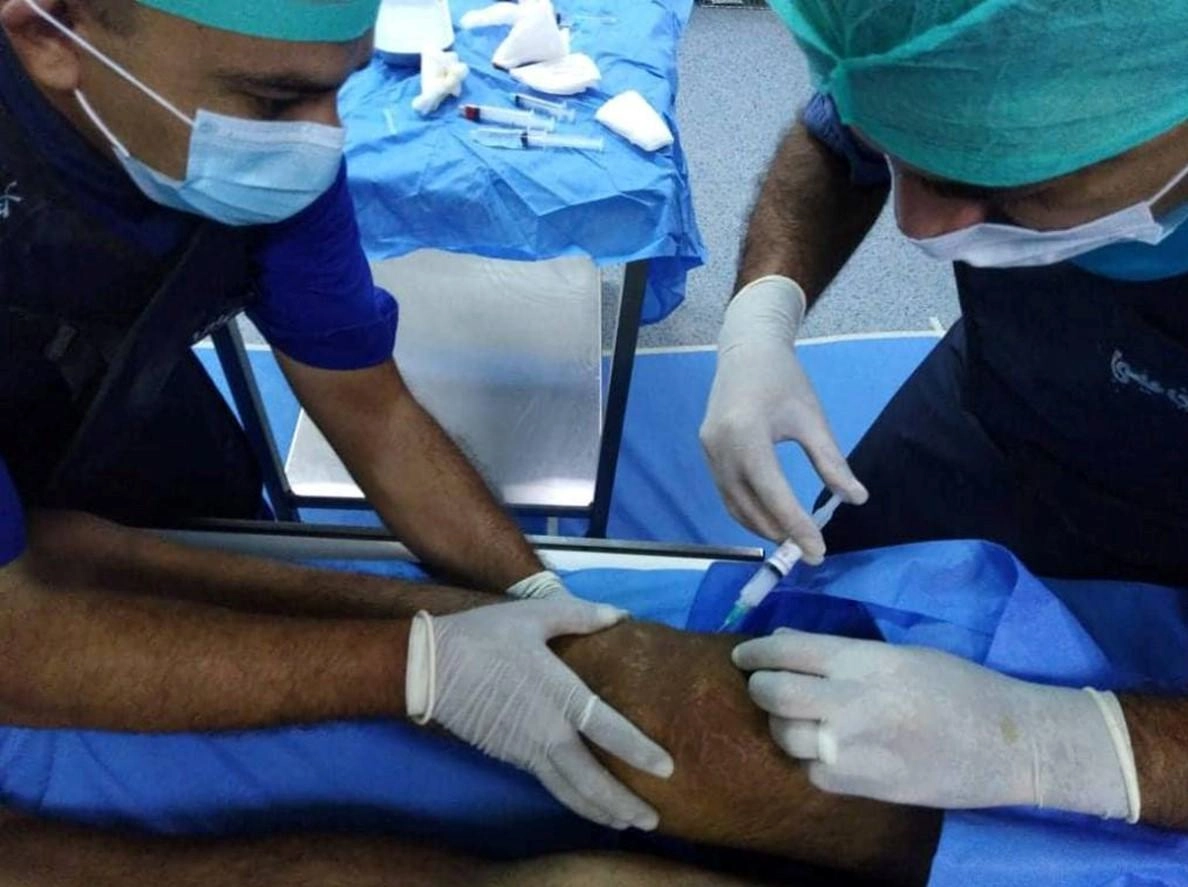 استخدام حقن النظائر المشعة في علاج ورم 