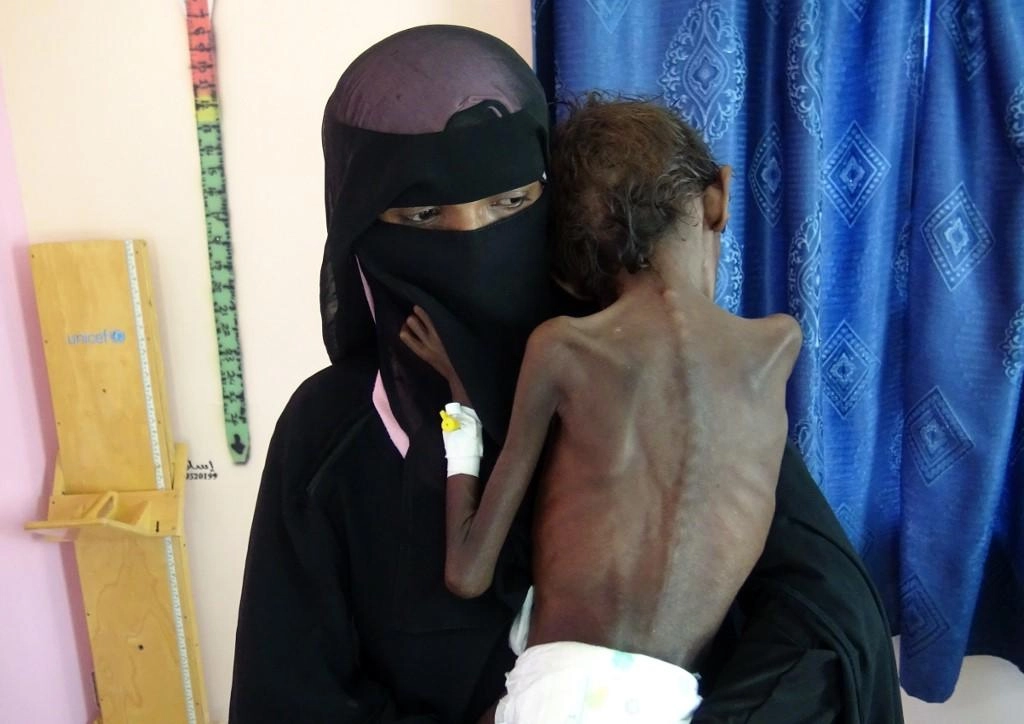 50 مليونا يعانون نقص تغذية في المنطقة