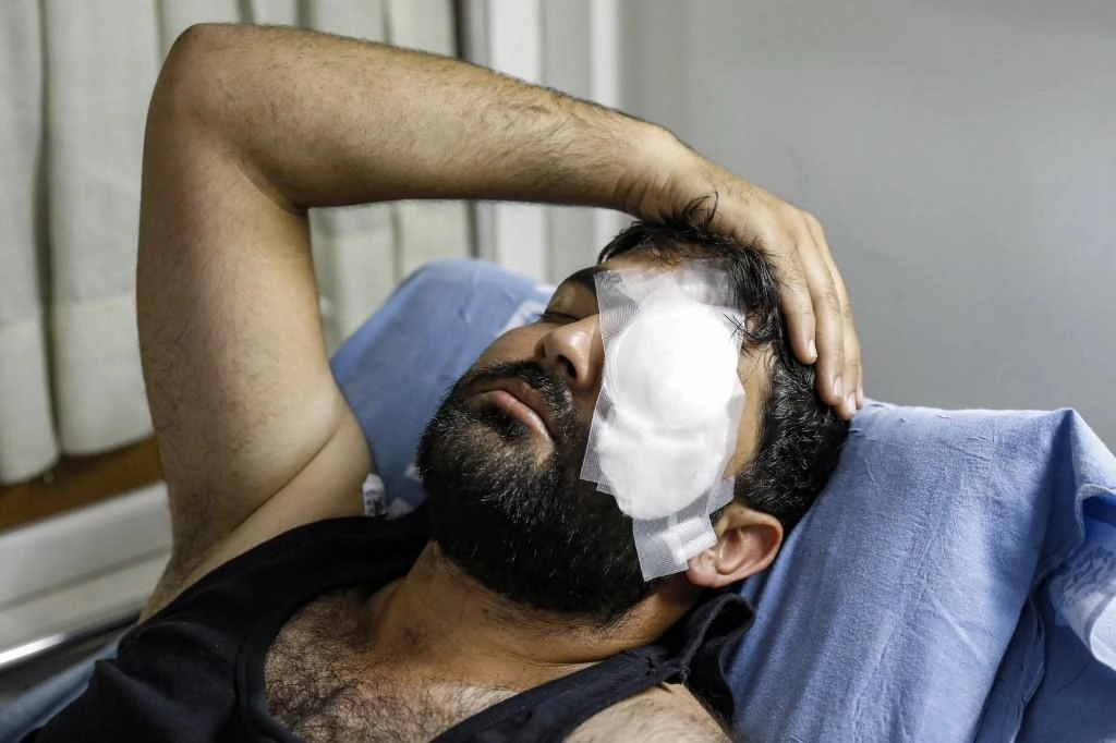 توجيه بمتابعة حالة مصور أصابته قوات إسرائيلية في عينه