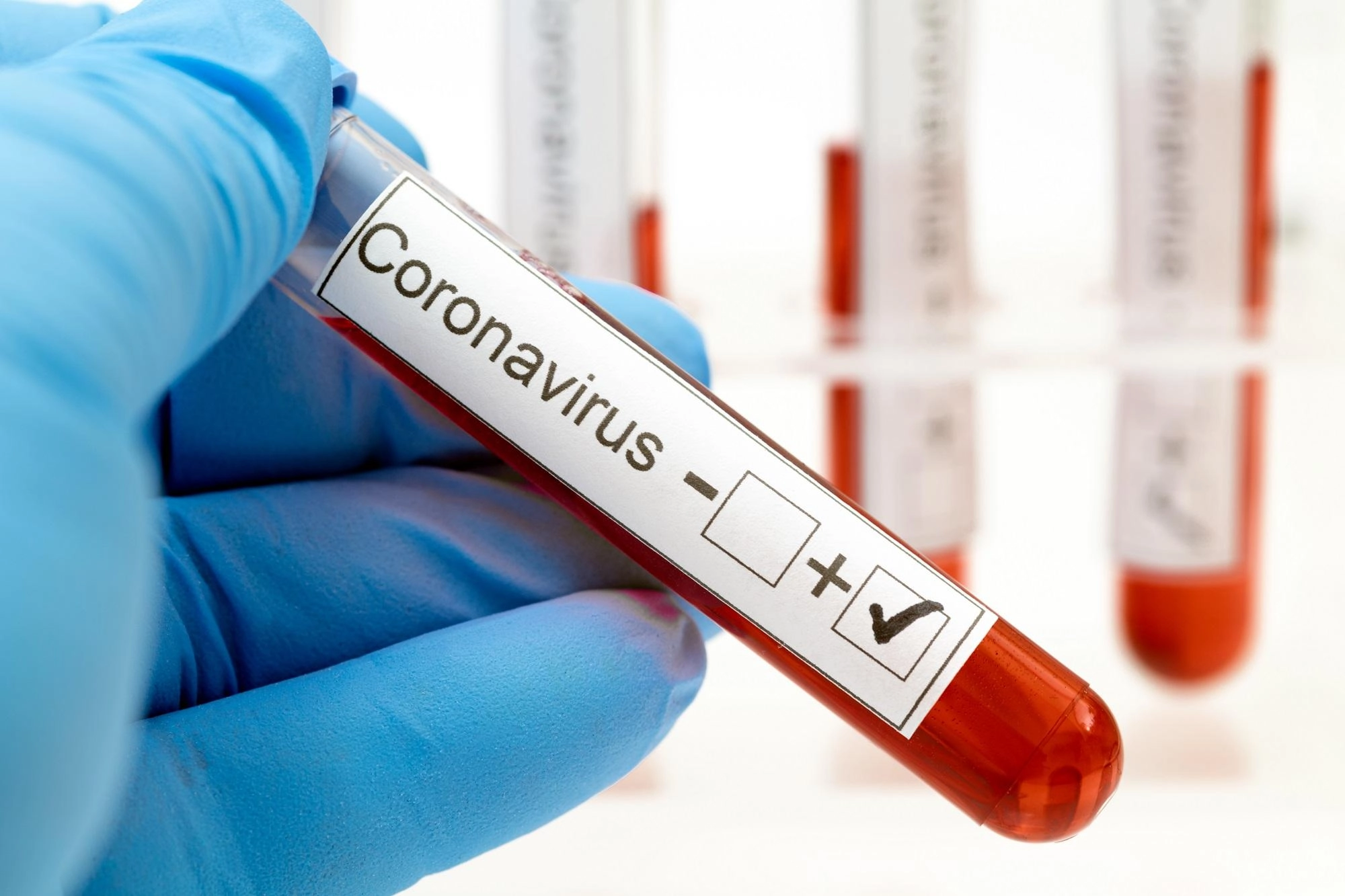 تطوع ألف طبيب للعمل في فرق طوارئ
