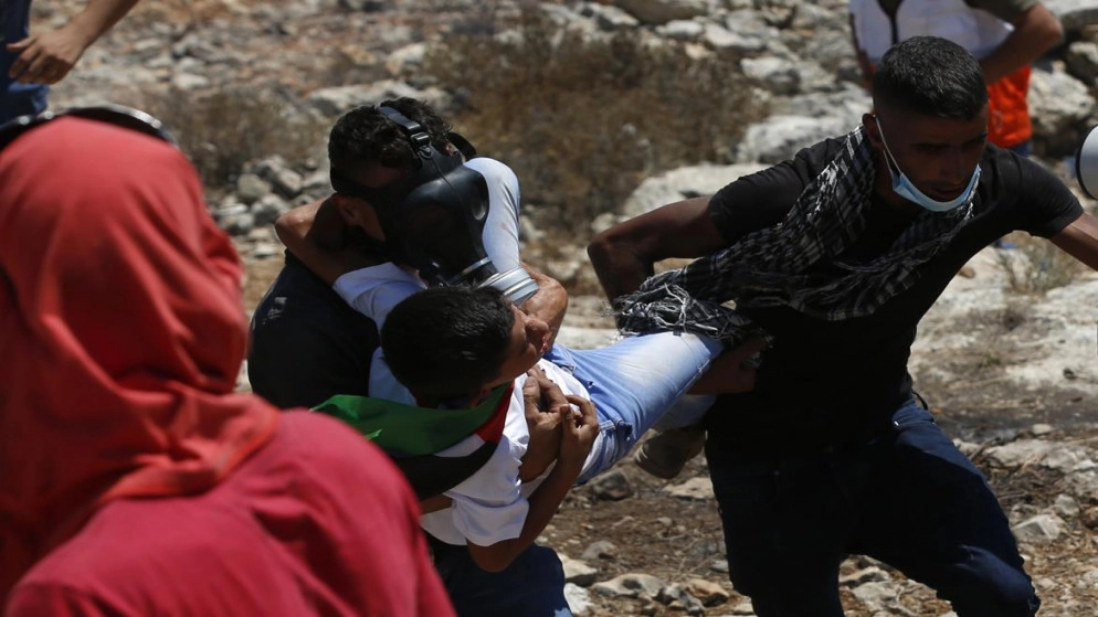 إصابة 408 فلسطينيين في مواجهات مع الاحتلال الإسرائيلي في بيتا وأوصرين في نابلس